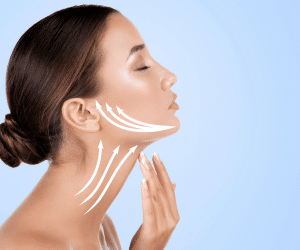 A woman lifting her chin, getting ready for a neck lift surgery in Thailand