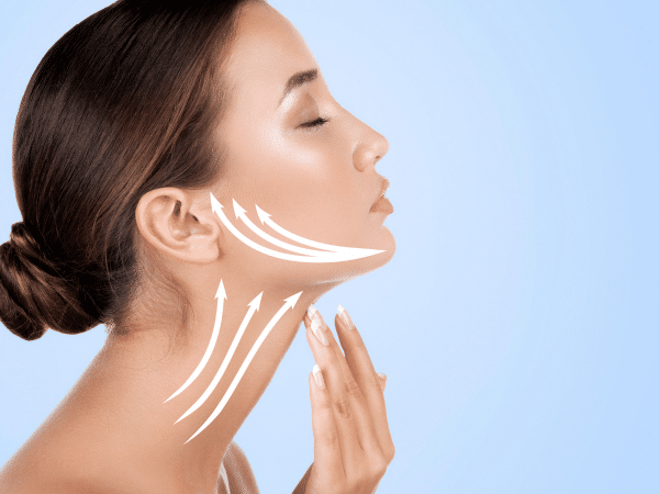 A woman lifting her chin, getting ready for a neck lift surgery in Thailand