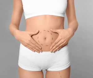 A woman putting her hands on her stomach, thinking about whether she should get a Tummy Tuck surgery or not