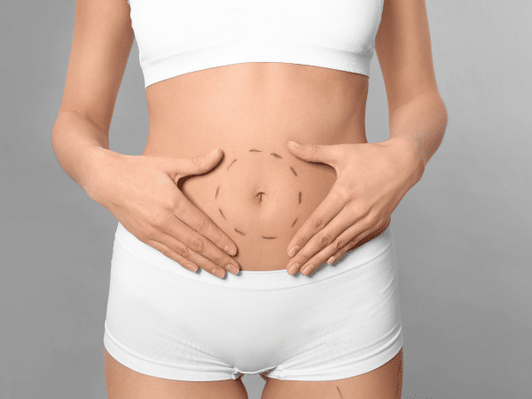 Tummy Tuck in Thailand: A Comprehensive Guide
