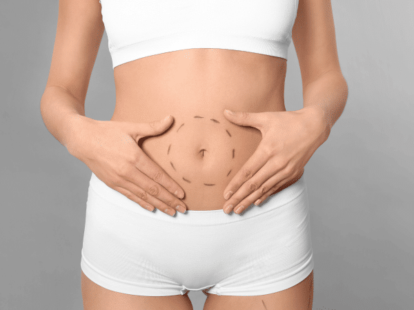 A woman putting her hands on her stomach, thinking about whether she should get a Tummy Tuck surgery or not