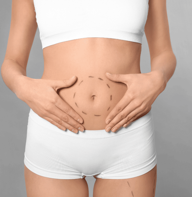 Tummy Tuck in Thailand: A Comprehensive Guide