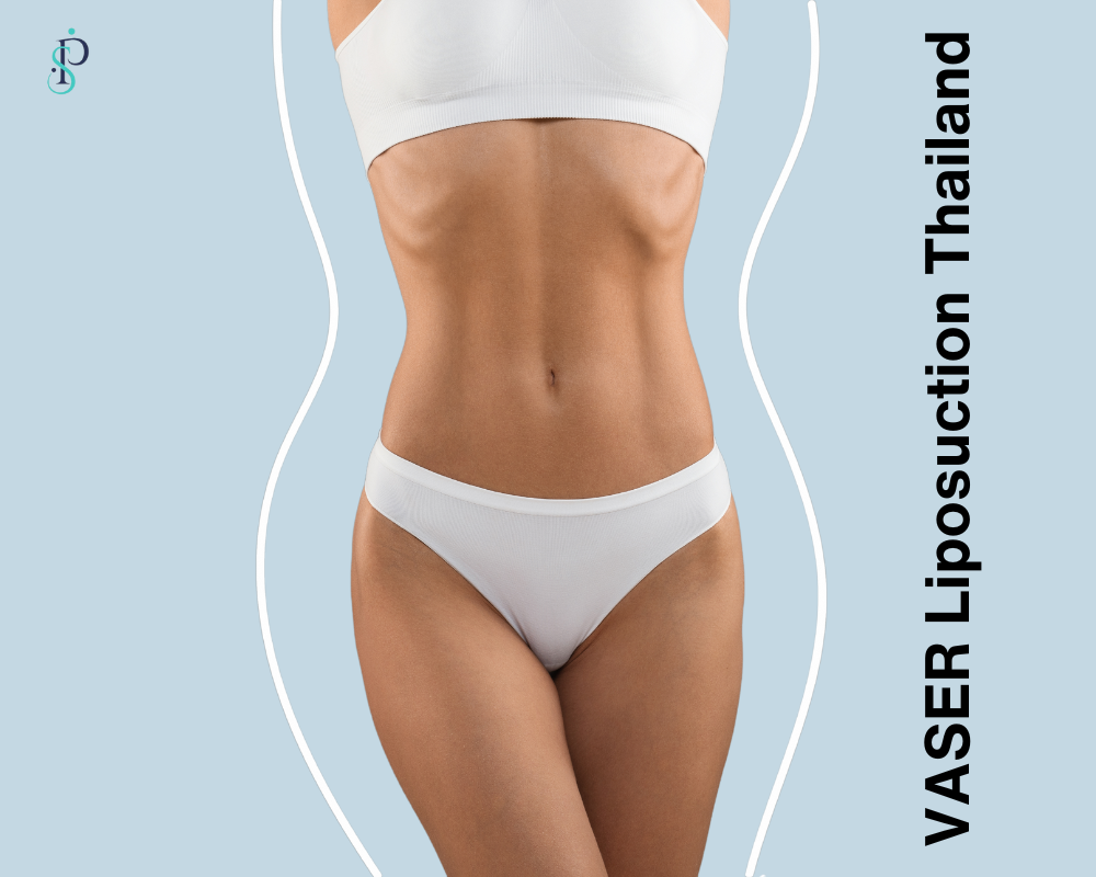 Weightloss. Slim Sporty Female Body In Underwear With Drawn Lines Around It