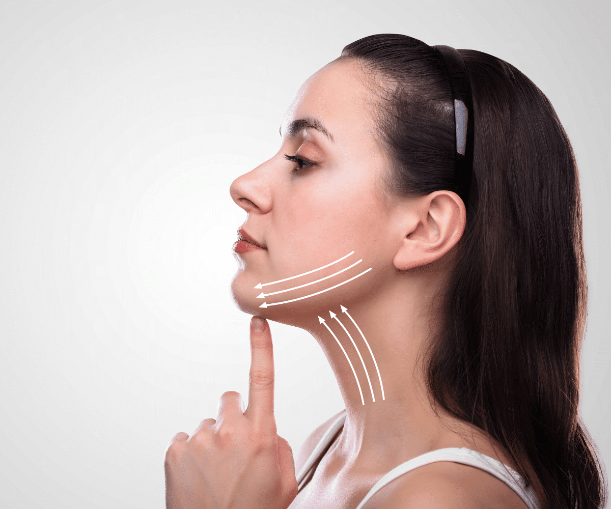 A woman pointing at her neck and marks done by a doctor for neck lift surgery showing on her face