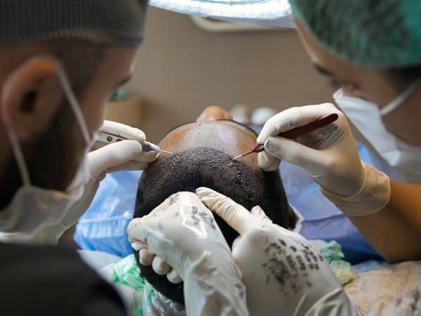 two doctors from Thailand preforming an hair transplant procedures