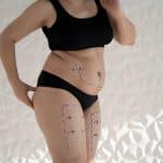 A woman body with liposuction marker traces side view
