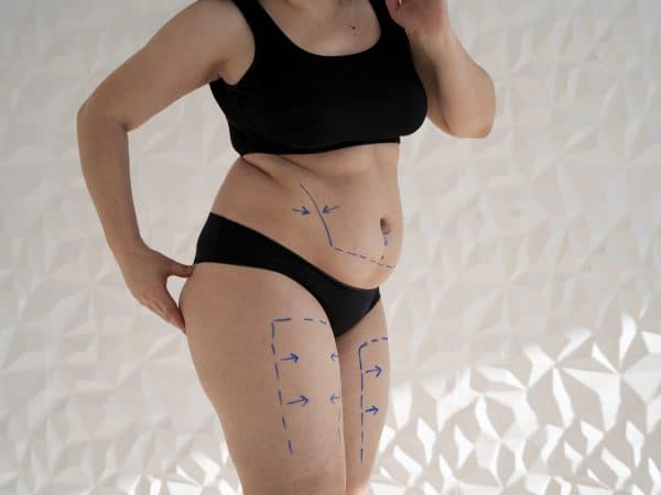 A Comprehensive Guide to Liposuction in Thailand